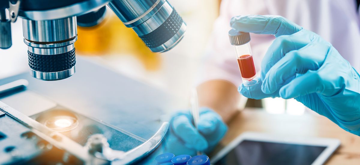 lab technician assistant analyzing a blood sample in test tube at laboratory with microscope. Medical, pharmaceutical and scientific research and development concept.