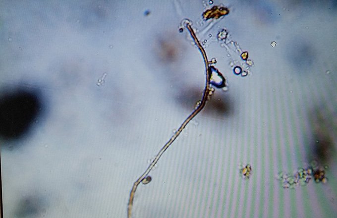 L’observation au microscope optique confirme la présence d’hyphes mycéliens dans  le TCO. Photo : Chemin cueillant