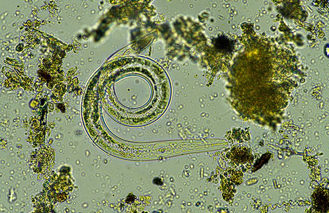 Le monde est microbien et particulièrement dans le sol.&nbsp;Ici, un nématode. Crédit:&nbsp;William/Adobe Stock