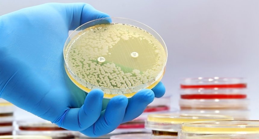 L’Anses partage une bonne nouvelle concernant l’antibiorésistance : le taux de bactéries résistantes aux antibiotiques continue de diminuer dans toutes les filières animales, sauf les équidés. © TopMicrobialStock/Adobe Stock