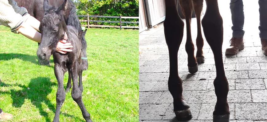 Les traitements médicaux et chirurgicaux des dévia