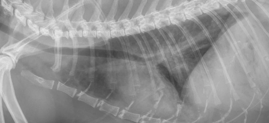 Radiographie thoracique et silhouette cardiaque : 