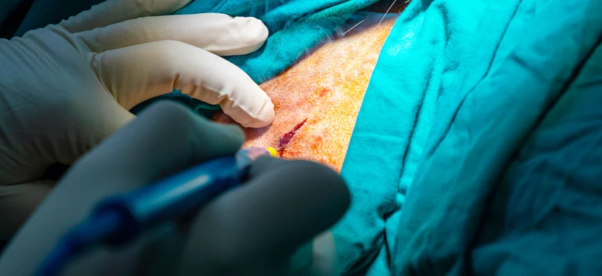 Bistouri électrique : un atout en chirurgie vétéri