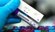 Leishmania - diagnostic